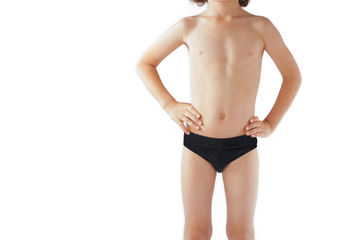 キッズ 男の子 光脱毛 Mパーツ